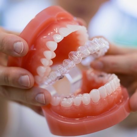 Modellgebiss mit einer Zahnschiene