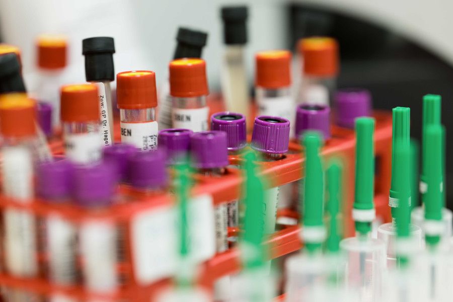 Bild von Blutabnahmen